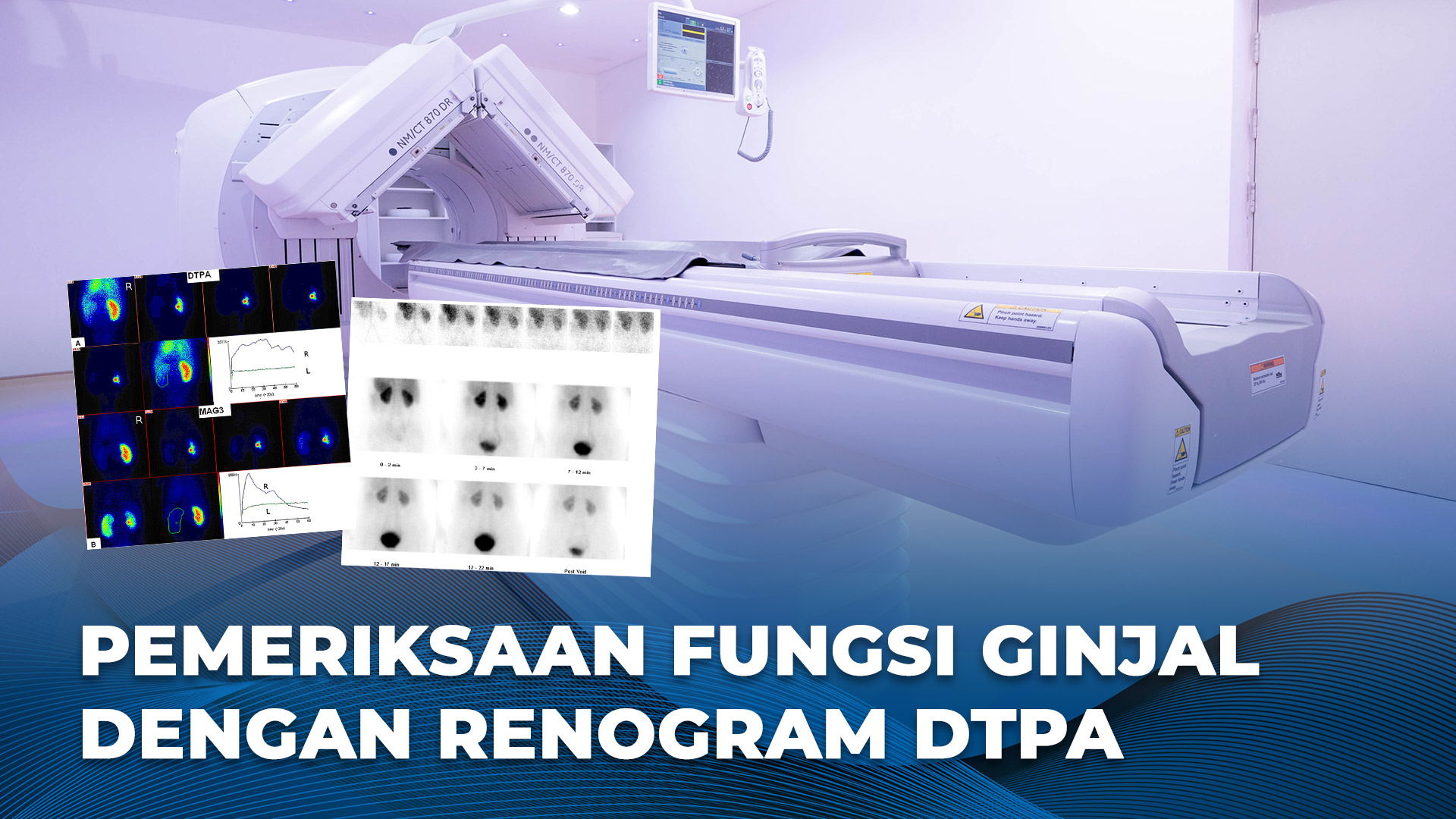 Renogram DTPA, Pemeriksaan Fungsi Ginjal Anak & Dewasa