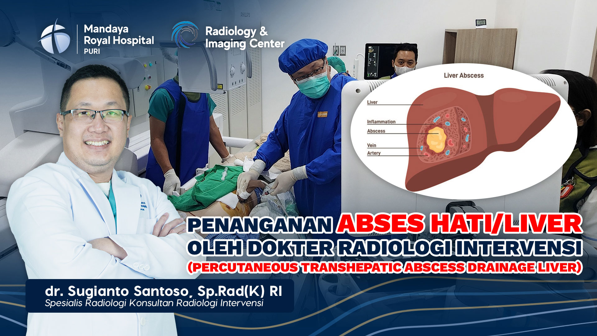 Treatment of Liver Abscess by Interventional Radiologists