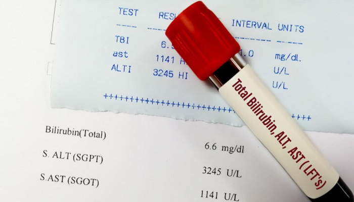 Tes SGOT SGPT: Tujuan, Nilai Normal, dan Arti Hasil Pemeriksaan