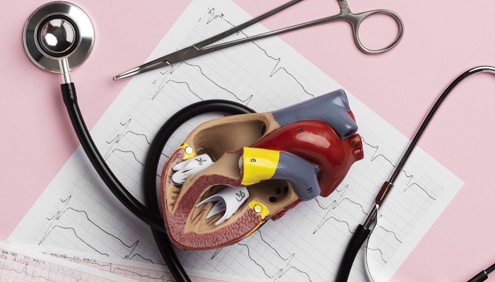 Operasi Penggantian Katup Jantung Ganda (DVR)L: Fungsi, Prosedur, dan Risiko