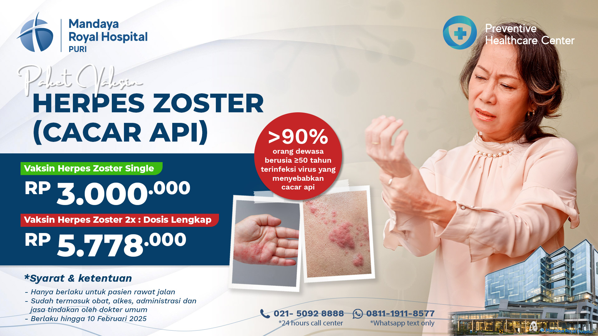 Harga Vaksin Herpes Zoster (Cacar Api) 2025 – Mandaya Royal Hospital Puri