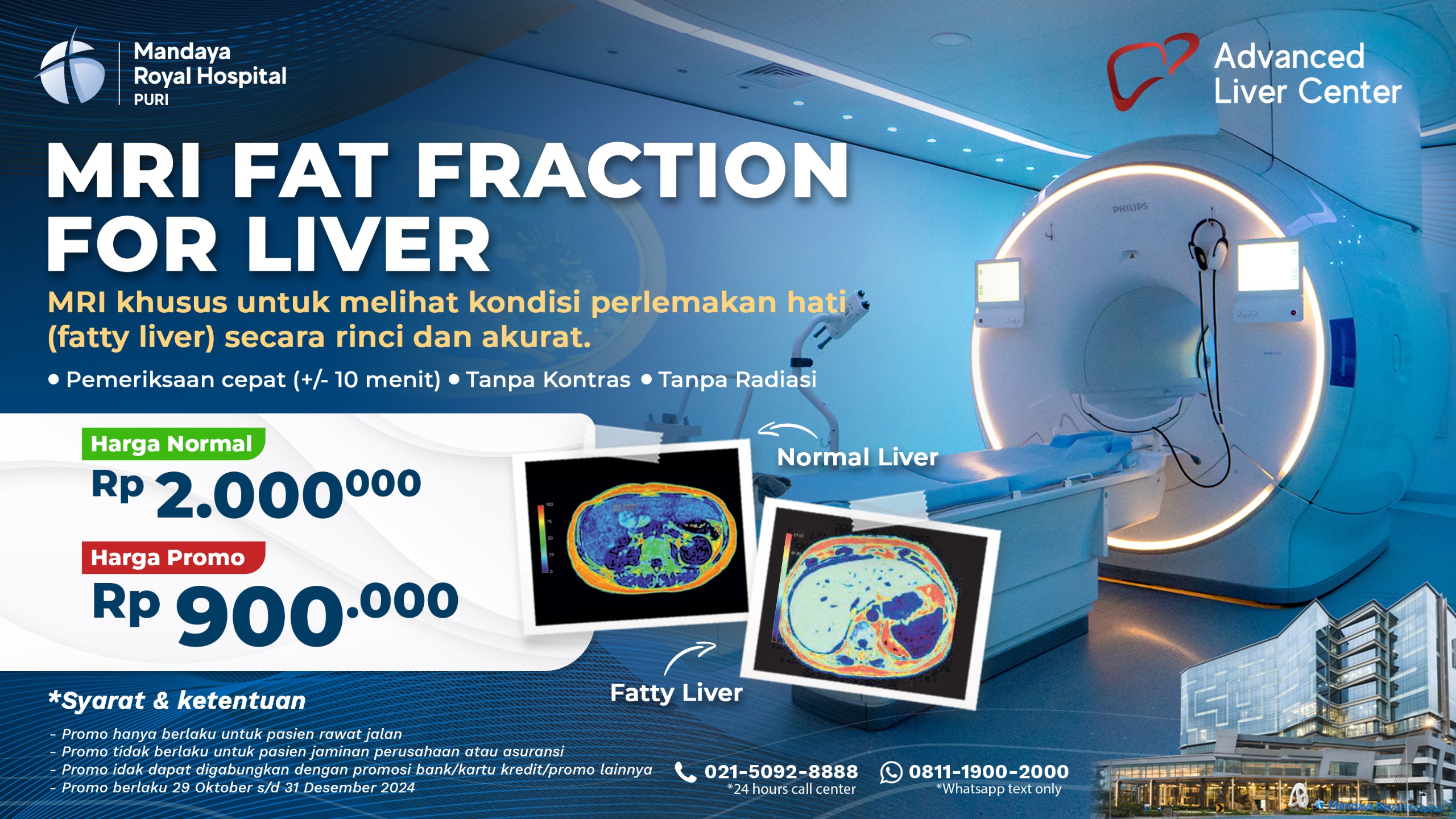 Biaya Paket Skrining Perlemakan Hati (Fatty Liver) 2024 - Mandaya Royal Hospital Puri