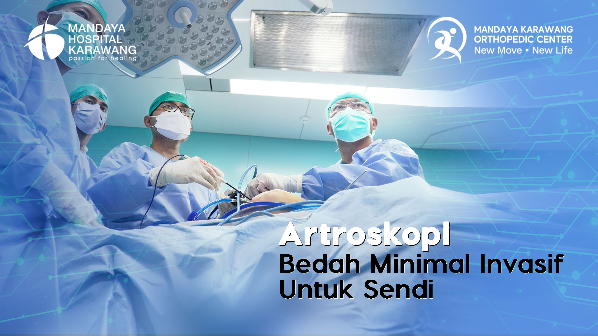 Prosedur Artroskopi Bedah Minimal Invasif Untuk Sendi