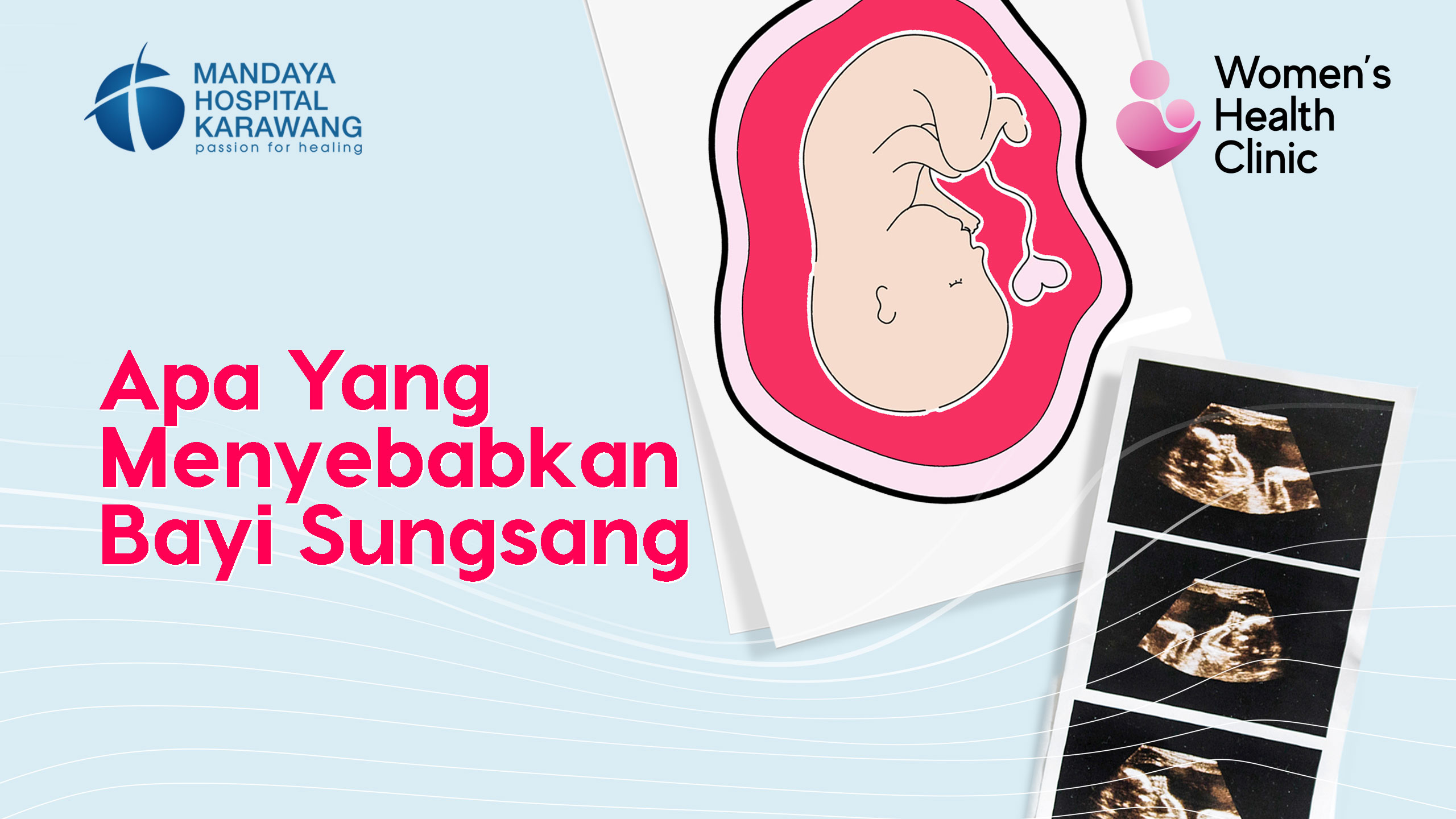 Apa Yang Menyebabkan Bayi Sungsang & Waspada Bahayanya