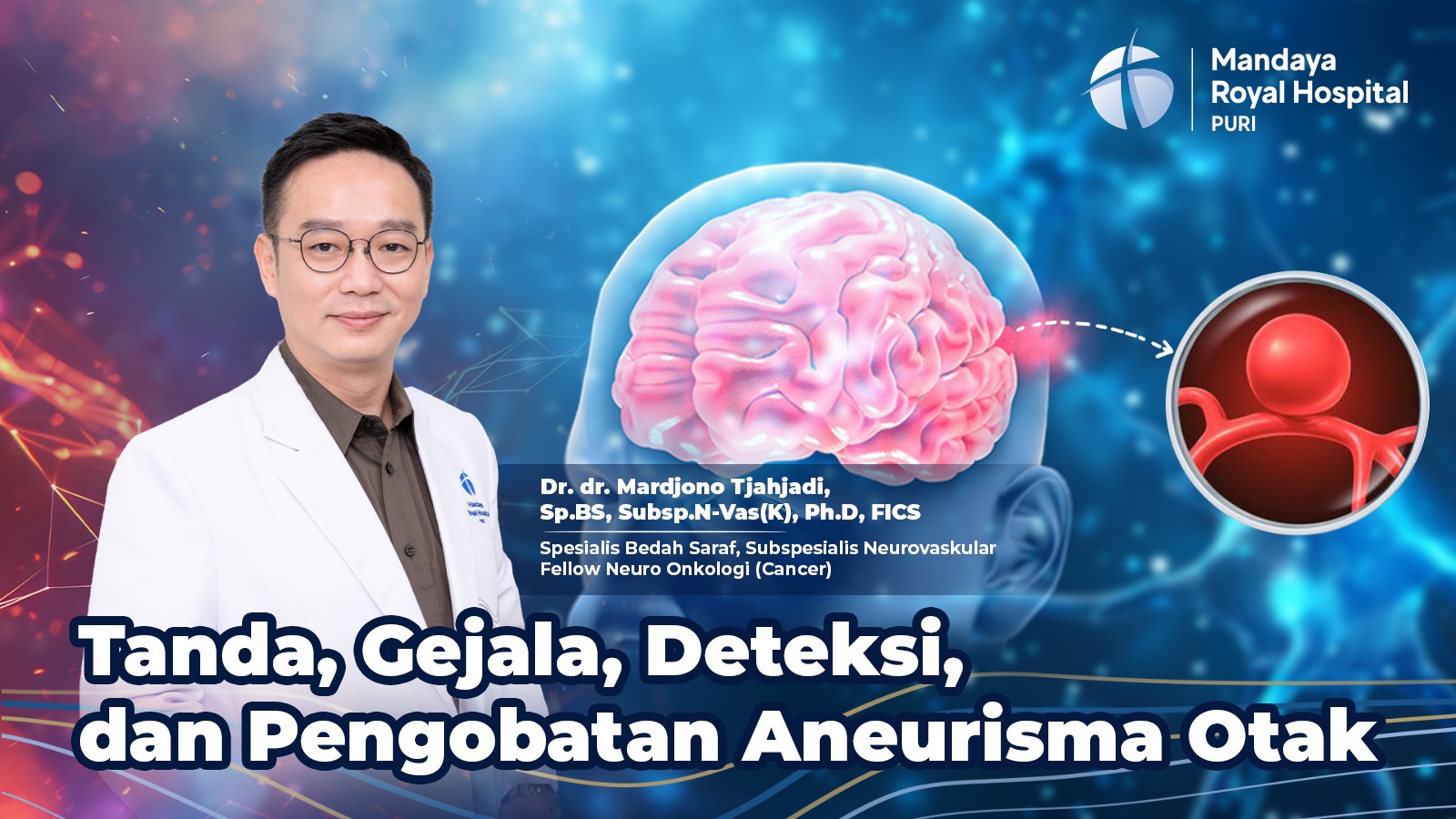 Aneurisma Otak, Tanda & Gejala Khas Menurut dr. Joy, Subspesialis Aneurisma