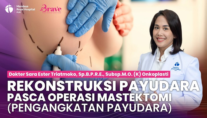 Dokter Spesialis Rekonstruksi Payudara untuk Pasien Kanker, dr. Sara Ester Triatmoko, Sp.B.P.R.E., Subsp.M.O. (K)