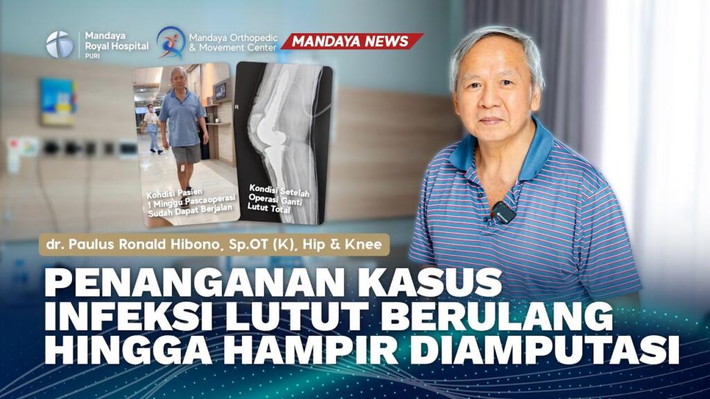 Keberhasilan Tim Ortopedi Mandaya dalam Revisi Lutut pada Pasien dengan Kondisi Infeksi