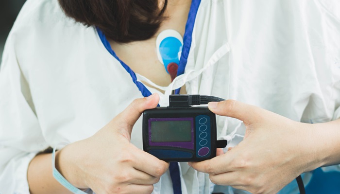 Holter Jantung: Pengertian, Prosedur Pemasangan, Tujuan, dan Hasilnya