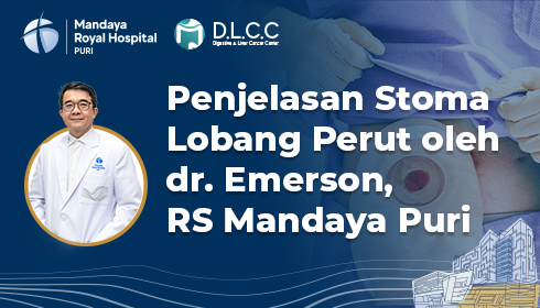 Penjelasan Stoma Lobang Perut oleh dr. Emerson, RS Mandaya Puri