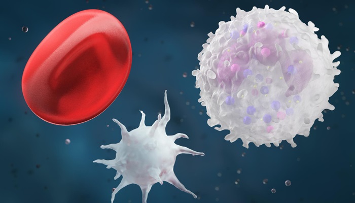Terapi Apheresis untuk Leukemia dapat Turunkan Kadar Leukosit