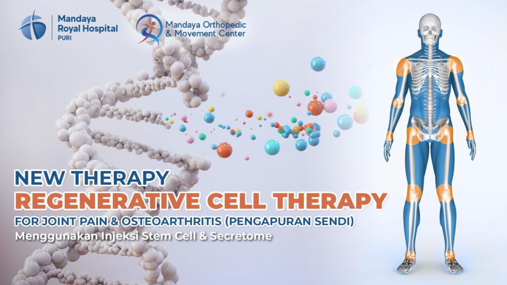 RS Mandaya Puri Luncurkan Layanan Stem Cell untuk Nyeri Sendi