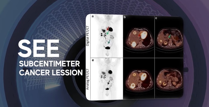 digital pet ct scan