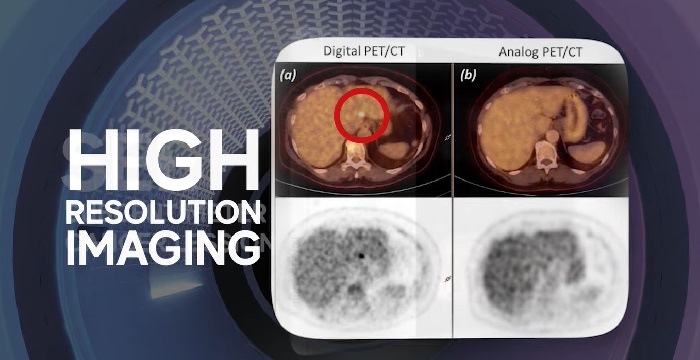 digital pet ct scan
