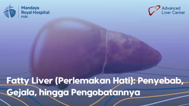 Fatty Liver (Perlemakan Hati): Penyebab, Gejala, hingga Pengobatannya