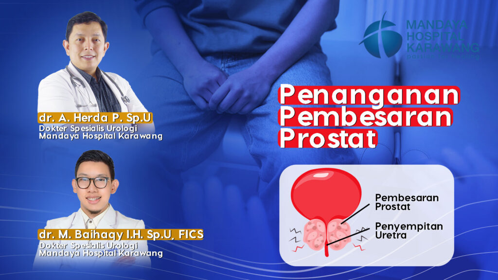 Penanganan Pembesaran Prostat di Karawang