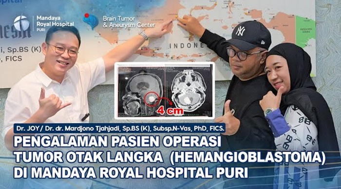 Pusat Otak Mandaya Berhasil Operasi Tumor Otak Langka, 1 per 1 Juta Kejadian