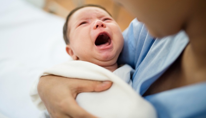 Bayi Kuning, Kapan Perlu Waspada?