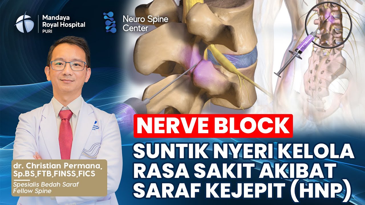 "Spine Nerve Block" Metode Kelola Nyeri Saraf Kejepit, RS Mandaya Royal Puri