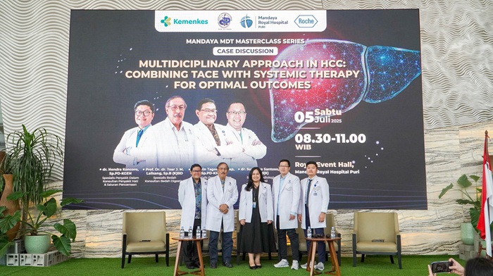 Tim Dokter Kanker Hati Mandaya Miliki Terapi Kombinasi Lawan Kanker Stadium Akhir