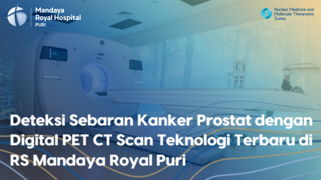 Deteksi Sebaran Kanker Prostat dengan Digital PET CT Scan Teknologi Terbaru di RS Mandaya Puri