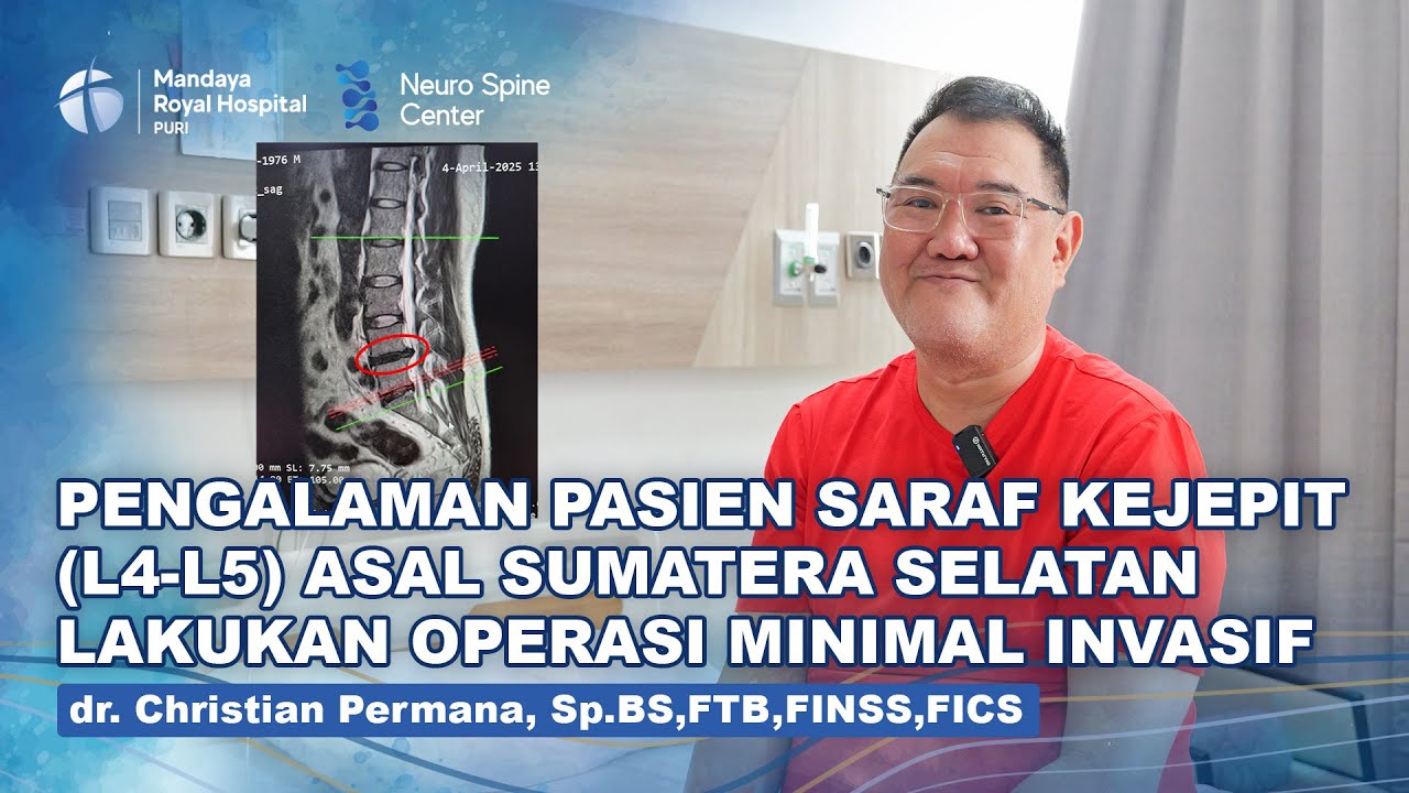 Pasien Saraf Terjepit Kembali Jalan Tanpa Nyeri Setelah Berobat dengan dr. Christian Permana di Mandaya Puri