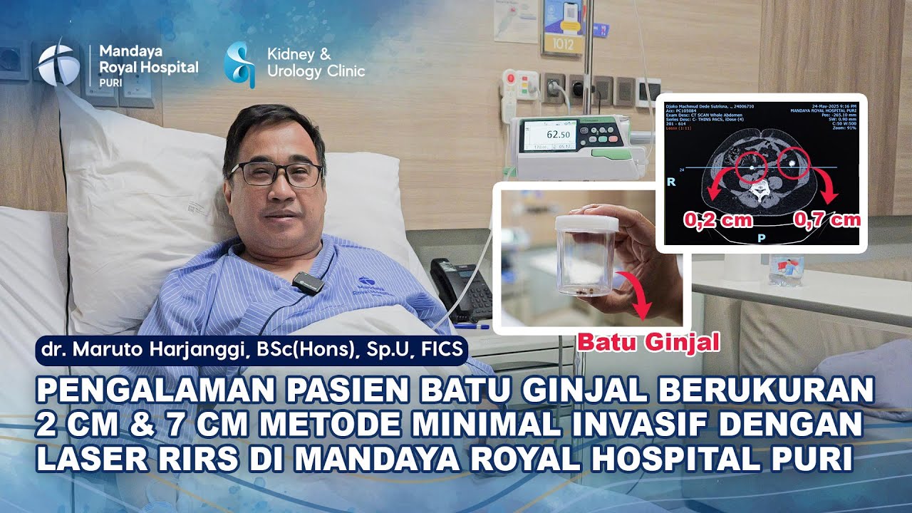Pengalaman Pasien Batu Ginjal Lakukan Operasi RIRS di RS Mandaya Royal Puri