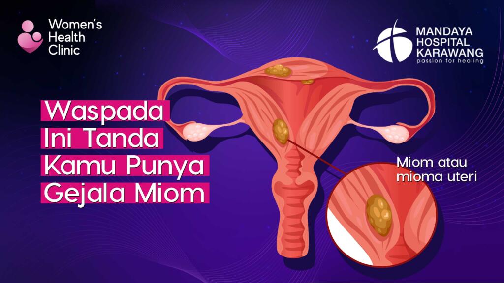 Waspada, Ini Tanda Kamu Punya Gejala Miom