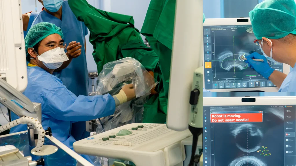 Tindakan REZUM untuk Pembesaran Prostat oleh dr. Maruto di RS Mandaya Royal Puri