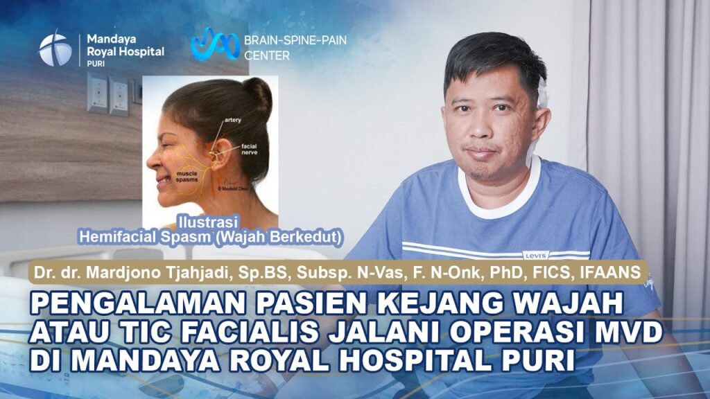 Pengalaman Pasien Hemifacial Spasm Menjalani Operasi Microvascular Decompression (MVD) di RS Mandaya Royal Puri