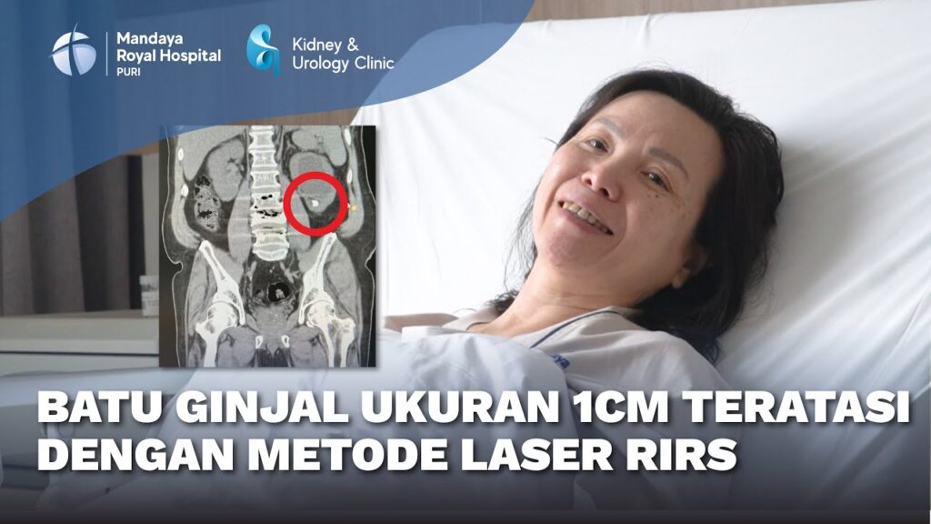 Pengalaman Pasien Batu Ginjal Menjalani Tindakan RIRS di Mandaya Royal Hospital Puri