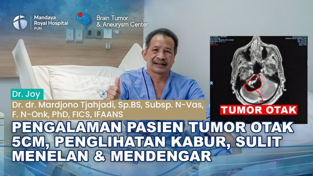 Pengalaman Pasien Tumor Otak 5 cm Jalani Operasi Microsurgery di RS Mandaya Royal Puri