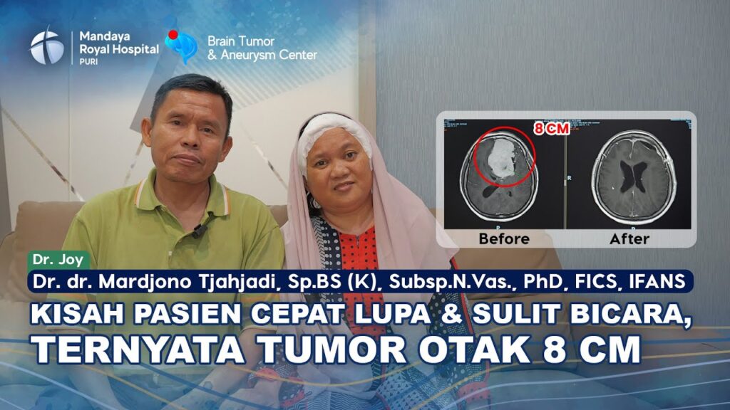 Pasien Tumor Otak 8 cm Jalani Operasi dengan Dr. Joy di RS Mandaya Puri, Tumor Terangkat 100 Persen
