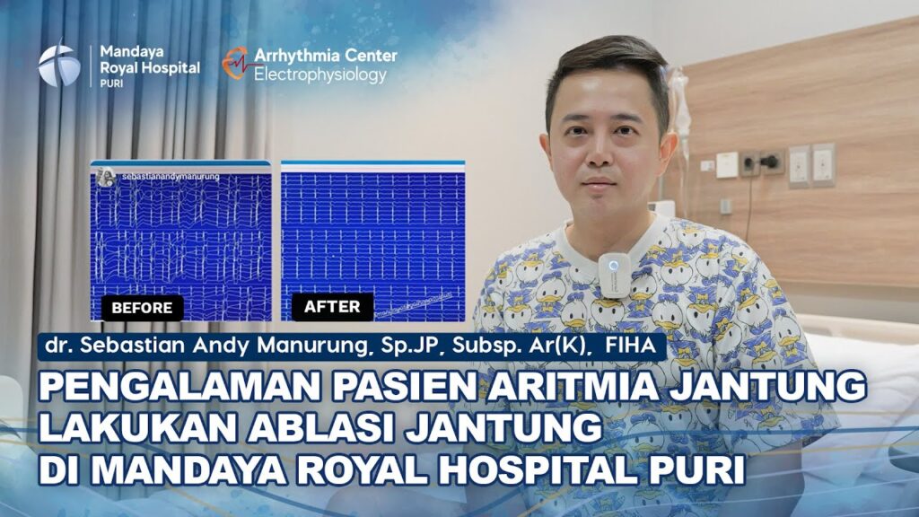 Kisah Pasien Aritmia PVC Jalani Ablasi Jantung di RS Mandaya Puri dengan dr. Sebastian