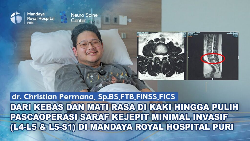 Testimoni Pasien Saraf Kejepit L4-L5 dan L5-S1 Cauda Equina Syndrome di Mandaya Royal Hospital Puri