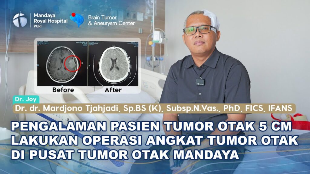 Testimoni Pasien Tumor Otak 5x4 Cm Lakukan Operasi dengan Dr. Joy di RS Mandaya Puri