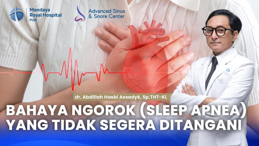 Penjelasan Bahaya Mendengkur oleh dr. Abdillah dan Penanganannya di RS Mandaya Puri