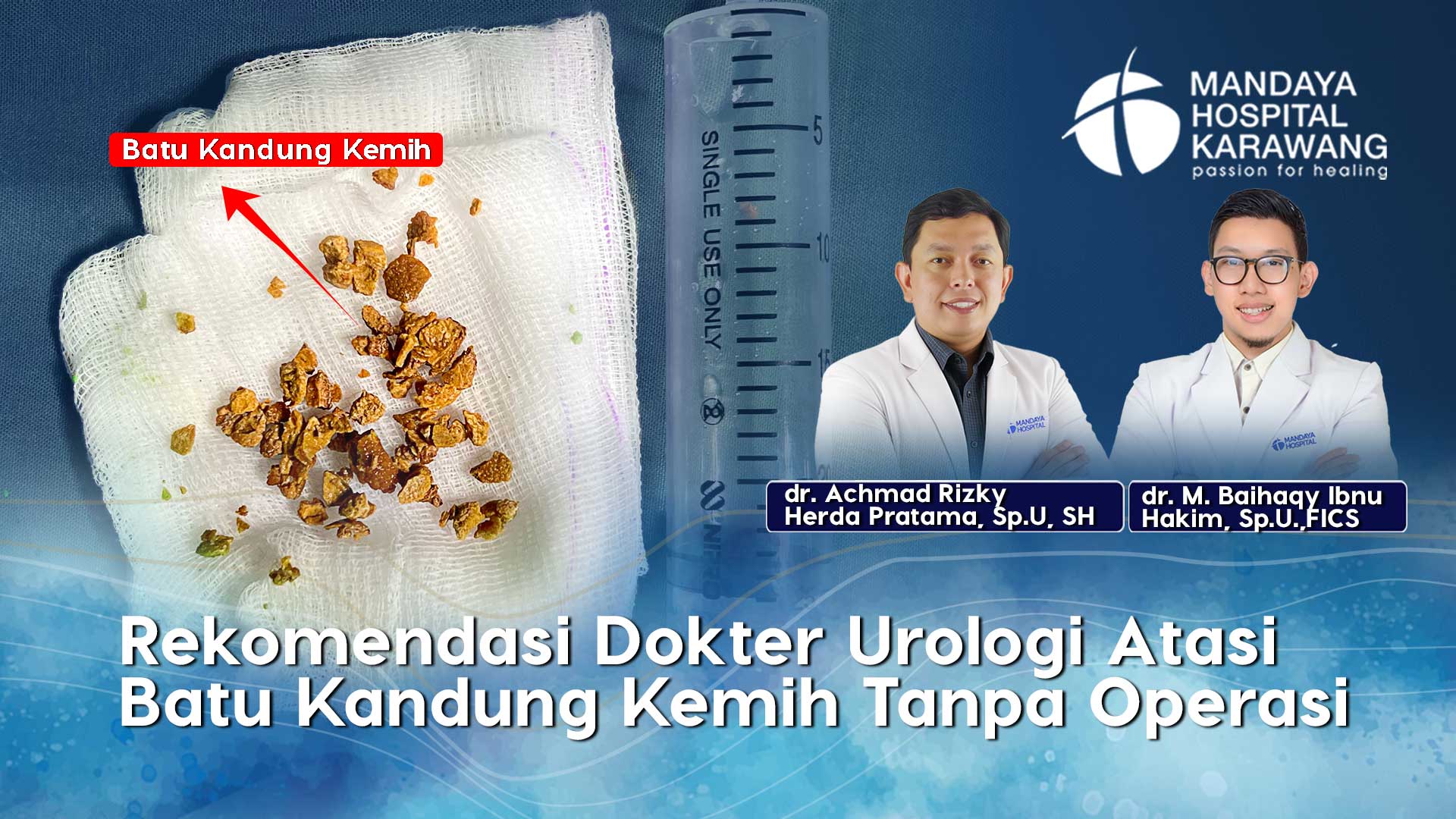 Rekomendasi Dokter Urologi Atasi Batu Kandung Kemih Tanpa Operasi di Karawang