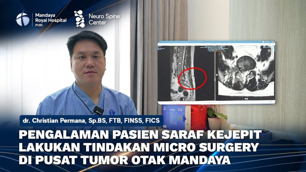 Pasien Saraf Terjepit L5-S1 Pulih Setelah Operasi Microsurgery 1 cm di Mandaya Royal Hospital Puri