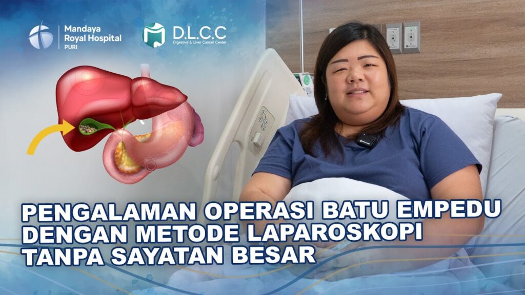 Pasien Pulih Cepat Setelah Pengangkatan Kantong Empedu dengan Metode Laparoskopi di Mandaya Royal Hospital Puri