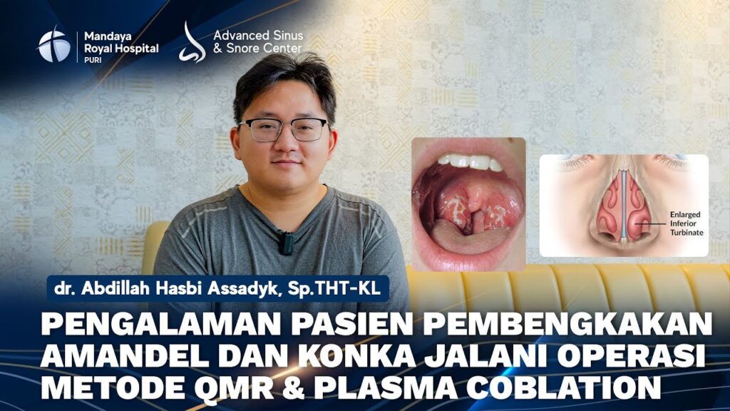 Pengalaman Pasien Pembengkakan Amandel dan Konka Jalani QMR dan Plasma Coblation RS Mandaya Puri