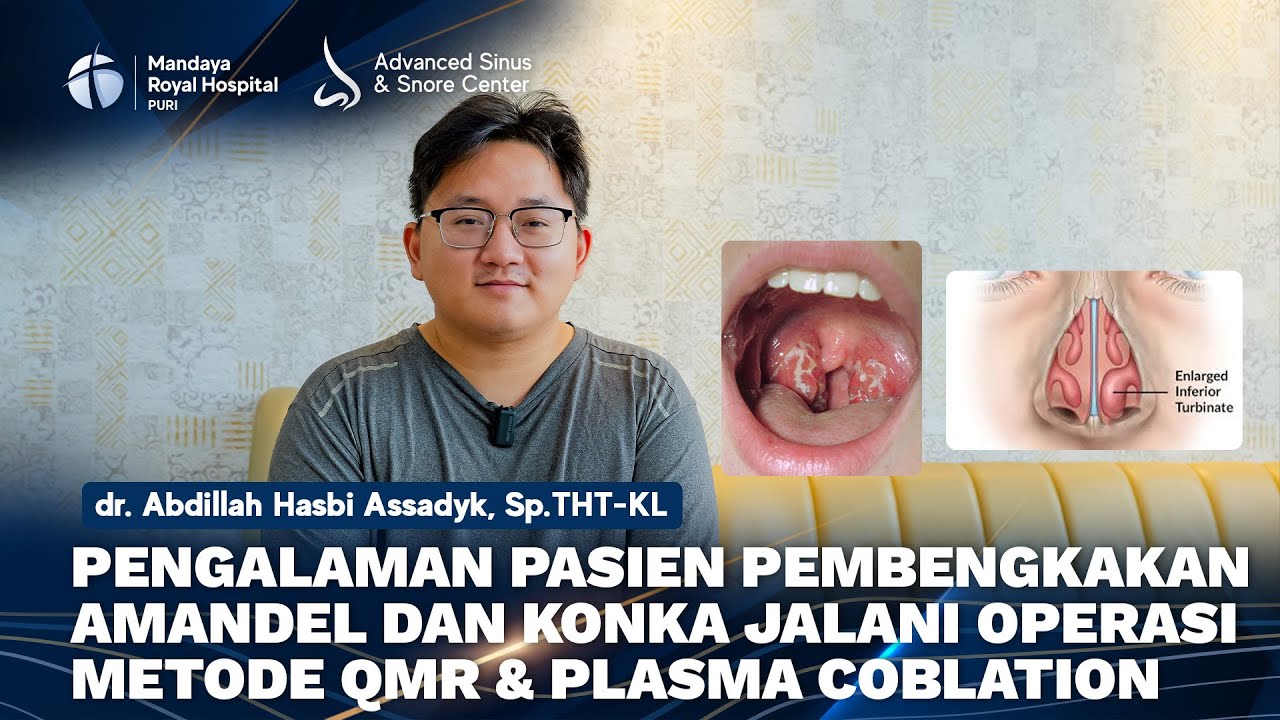 Pengalaman Pasien Pembengkakan Amandel dan Konka Jalani QMR dan Plasma Coblation RS Mandaya Puri