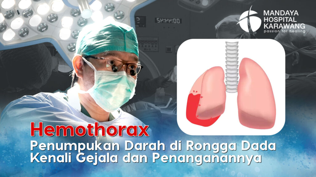 Hemothorax Penumpukan Darah di Rongga Dada : Kenali Gejala dan Penanganannya