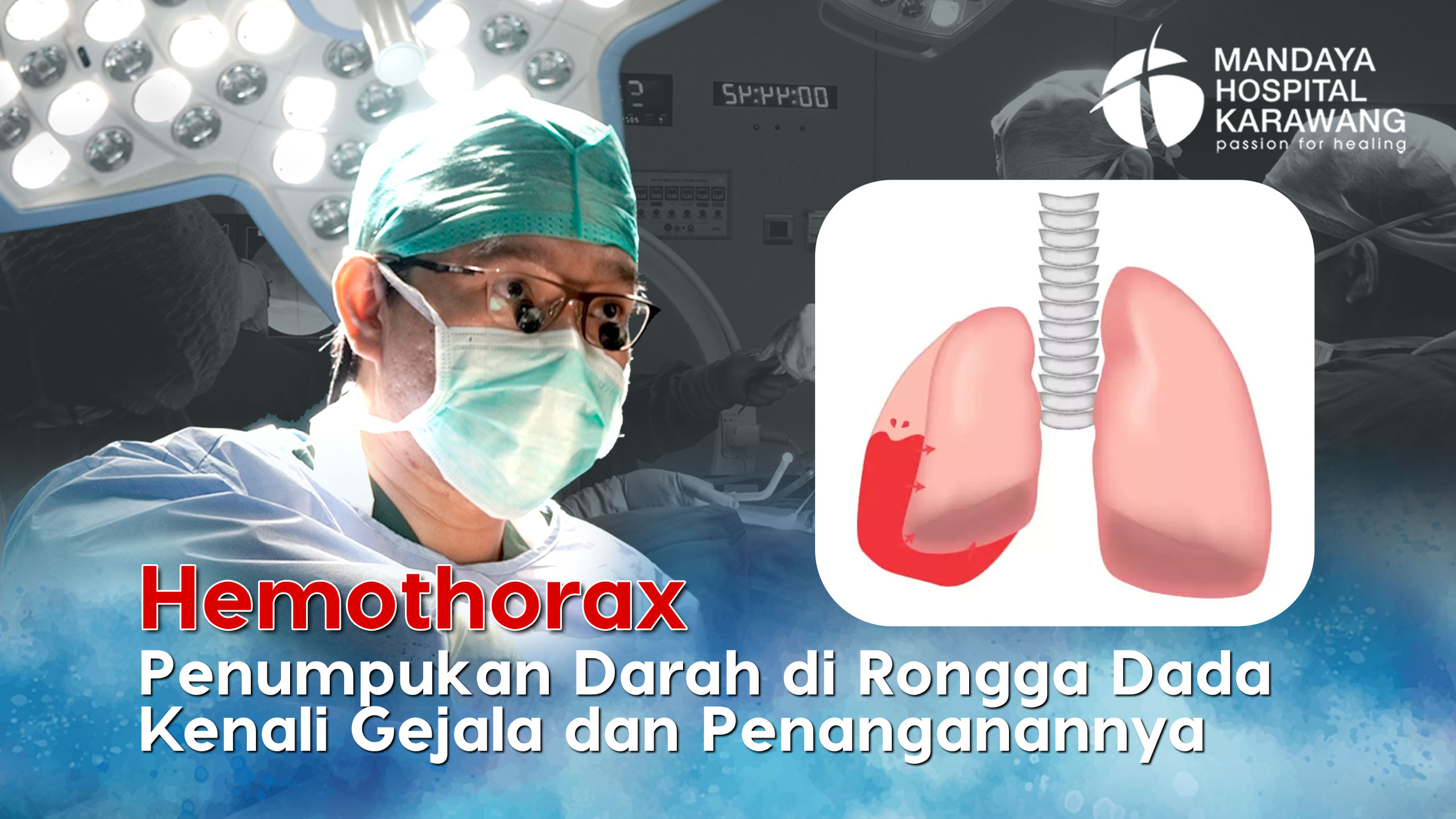 Hemothorax Penumpukan Darah di Rongga Dada : Kenali Gejala dan Penanganannya