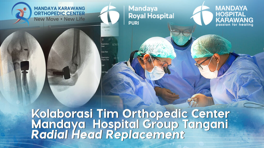 Kolaborasi Tim Mandaya Orthopedic Center Tangani Kasus Radial Head Replacement