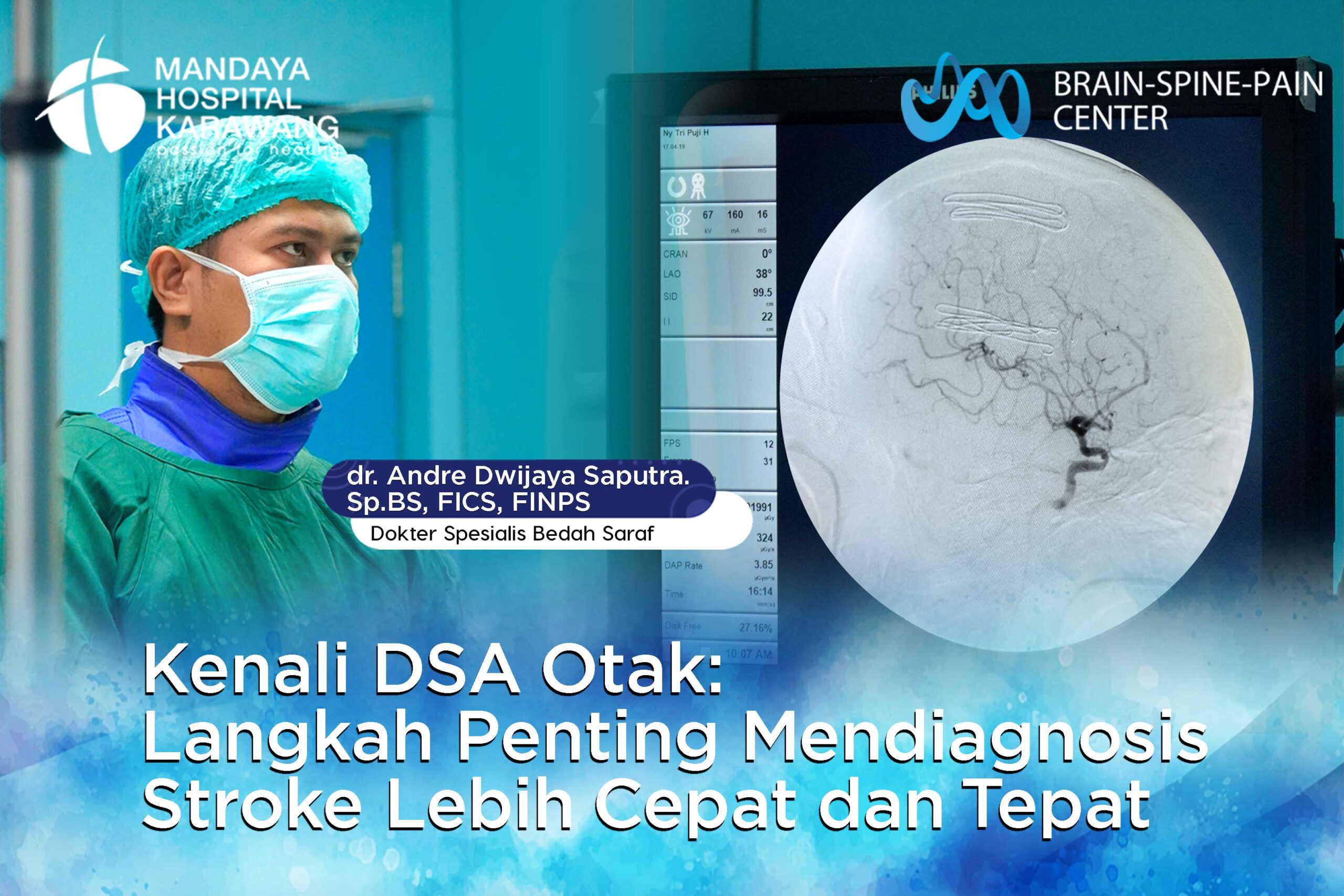 Kenali DSA (Digital Subtraction Angiography) Otak: Langkah Penting Mendiagnosis Stroke Lebih Cepat dan Tepat