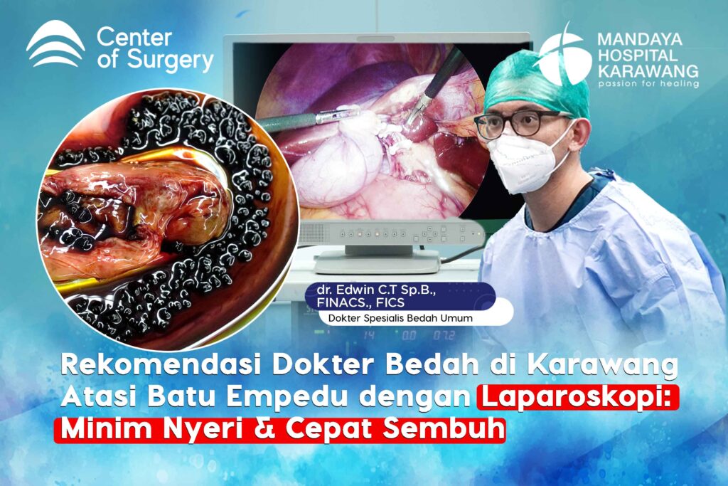 Rekomendasi Dokter Bedah di Karawang Atasi Batu Empedu dengan Laparoskopi: Minim Nyeri & Cepat Sembuh