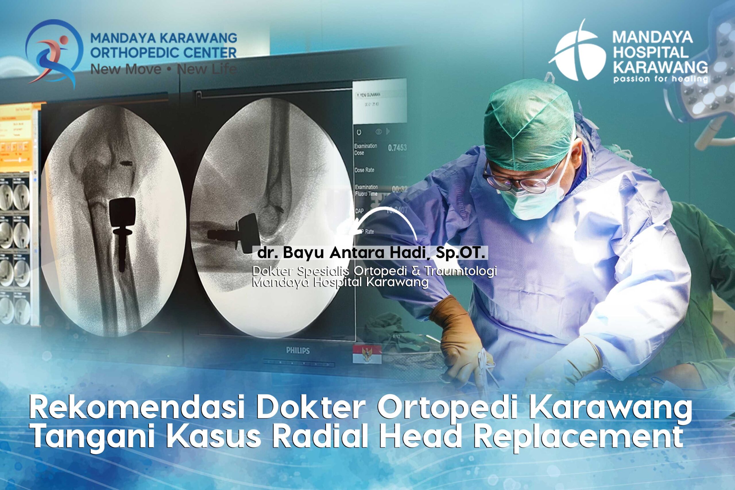 Rekomendasi Dokter Ortopedi Karawang Tangani Kasus Radial Head Replacement: Solusi Modern Mengatasi Cedera Siku Berat