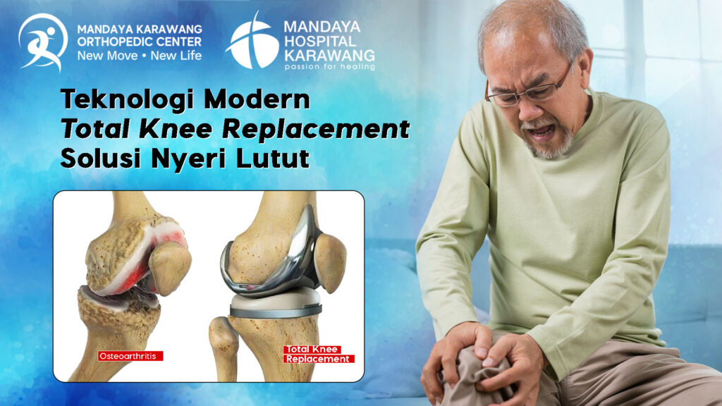 Teknologi Modern Total Knee Replacement, Solusi Nyeri Lutut Anda bersama dr. Heppy di RS Mandaya Karawang