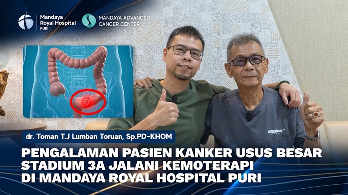 Stage 3A Colon Cancer Patient Shares Chemotherapy Experience at Mandaya Royal Hospital Puri