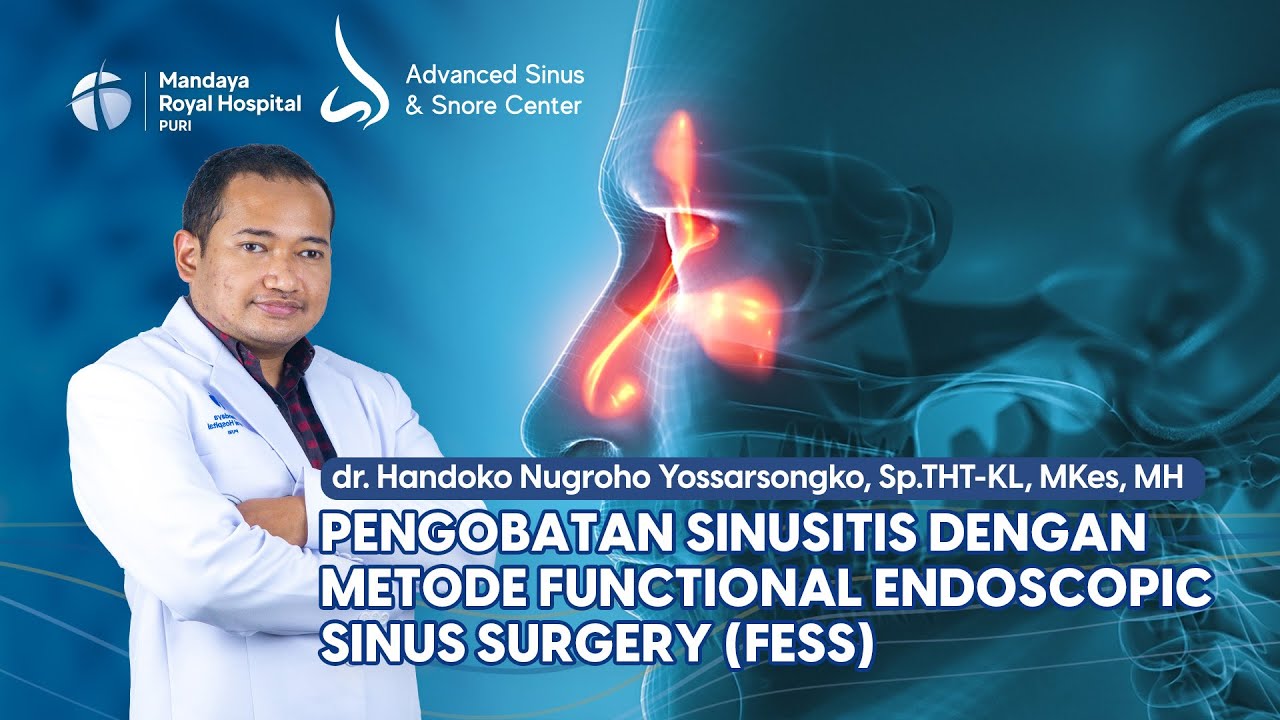 Pengobatan Sinusitis dengan Metode FESS oleh dr. Handoko di RS Mandaya Puri